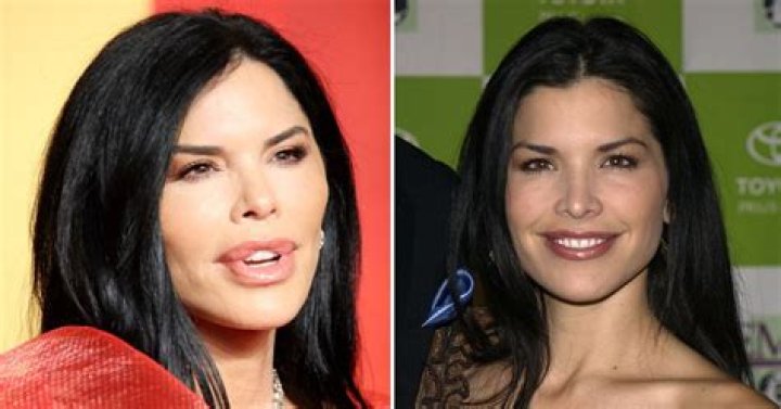 
Talisa Garcia Before Surgery Photos And Name – Willow Actress Gender Sexuality & Partner 2022 