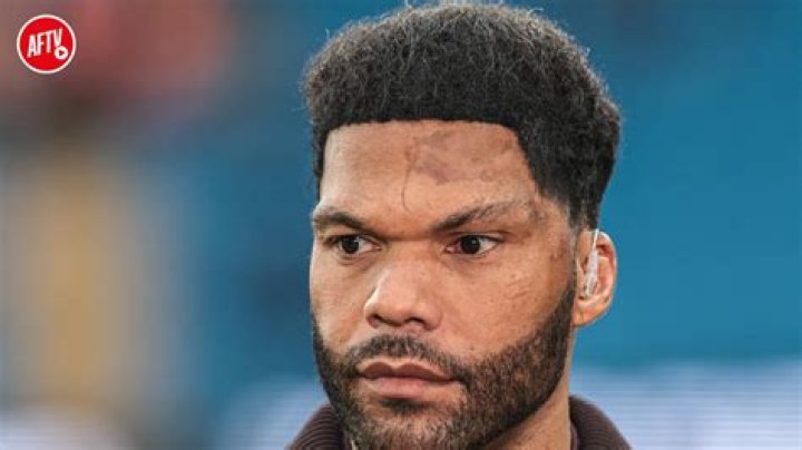 
What Happened To Joleon Lescott Head? Scar After An Accident 